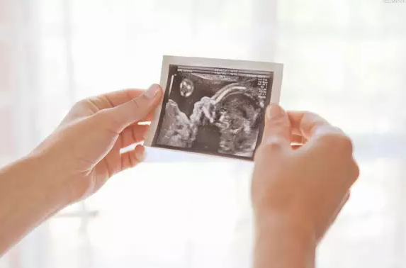 孕妇胎盘老化要注意什么问题呢？